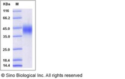 Sino Biological Recombinant Human CD16a/FCGR3A/Fc gamma RIIIA Protein (F176,
