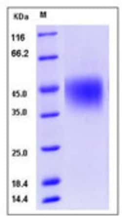 Sino Biological Recombinant Human CD16a/FCGR3A/Fc gamma RIIIA Protein (V176,