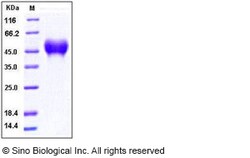 Sino Biological Recombinant Human CD16a/FCGR3A/Fc gamma RIIIA Protein (F176,