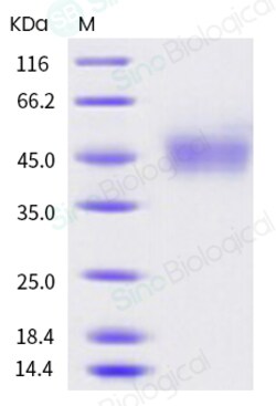 Sino Biological Human CD16a / FCGR3A Protein (176 Val, His & AVI Tag),