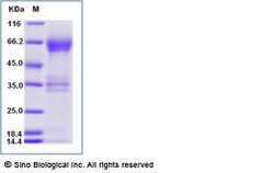 Sino Biological Recombinant Human TIM-3/HAVCR2 Protein (ECD, hFc Tag) 1