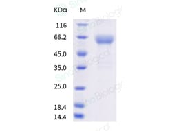 Sino Biological Recombinant Human TIM-3/HAVCR2 Protein (hFc & AVI Tag),