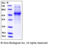 Sino Biological Human IL5Ra / CD125 Protein (His Tag) 50ug, Quantity: Each