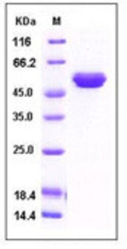 Sino Biological Recombinant Human TIMP2 Protein (hFc Tag), Quantity: Each
