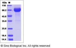 Sino Biological Recombinant Human IL-20R alpha/IL-20RA Protein (ECD, hFc