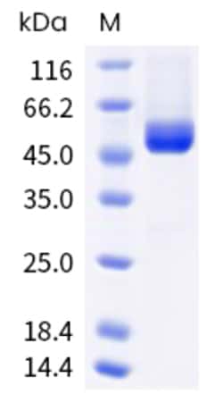 Sino Biological Recombinant Human CD4 Protein (His & AVI Tag), Biotinylated,