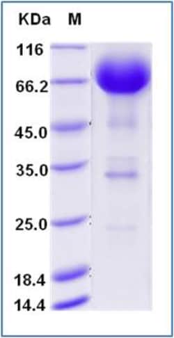 Sino Biological Human IL-4R / CD124 Protein (Fc Tag) 100ug, Quantity: Each
