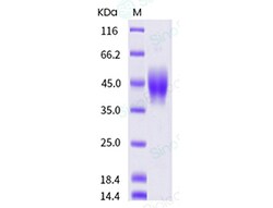 Sino Biological Human IL4R / CD124 Protein (His Tag) 500ug, Quantity: Each
