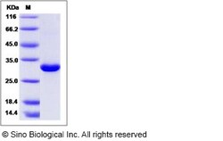 Sino Biological Recombinant Human Mannan Binding Lectin/MBL2 Protein, HPLC-verified,