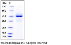 Sino Biological Human TRAIL R1 / CD261 / TNFRSF10A Protein (Fc Tag) 100ug,