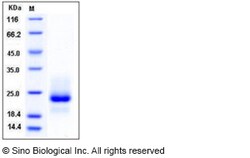 Sino Biological Recombinant Human DR4/TRAIL R1 Protein (His Tag), HPLC-verified,