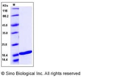 Sino Biological Recombinant Human TRAIL/TNFSF10 Protein, Quantity: Each
