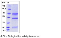 Sino Biological Recombinant Human Hemojuvelin Protein (His Tag), Quantity: