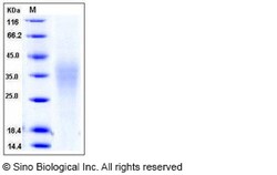 Sino Biological Human TRAIL R4 / CD264 / TNFRSF10D Protein (His Tag) 100ug,