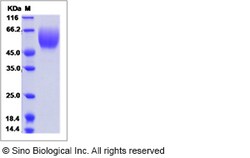 Sino Biological Recombinant Human DcR1/TRAILR3 Protein (His Tag), Quantity: