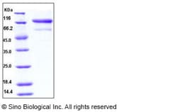 Sino Biological Recombinant Human TNFR-2 / CD120b Protein (ECD, His & hFc