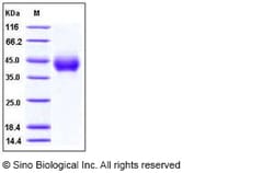 Sino Biological Recombinant Human TNFR-2 / CD120b Protein (ECD, His Tag),
