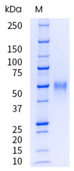 Sino Biological&nbsp;Recombinant Human TNFR-2 / CD120b Protein (aa 1-268, 196 Met/Arg, His Tag), HPLC-verified, Endotoxin-Free