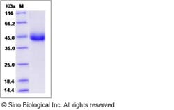 Sino Biological Human TNFR2 / CD120b / TNFRSF1B Protein (aa 1-268, 196