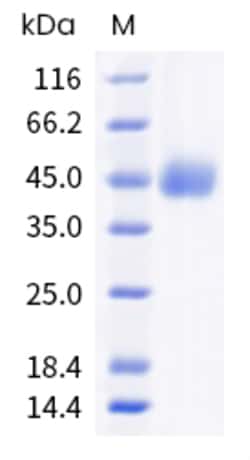 Sino Biological Recombinant Human TNFR-2 / CD120b Protein (ECD, His & AVI