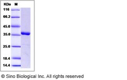 Sino Biological Recombinant Human MKK6 Protein, Quantity: Each of 1