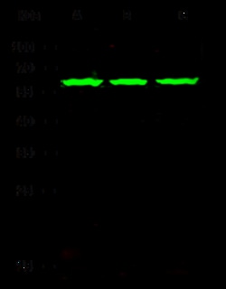 Sino Biological Anti-Vitronectin Antibody, Rabbit Polyclonal, Quantity: