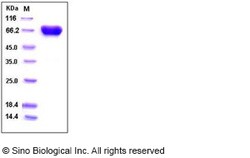 Sino Biological Human TROP2 / TACSTD2 Protein (His & Fc Tag) 1mg, Quantity: