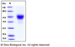 Sino Biological Human TROP2 / TACSTD2 Protein (His Tag) 100ug, Quantity:
