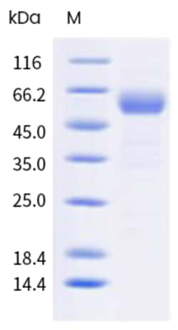Sino Biological Human TACSTD2 Protein 100ug (Sino Biological), Quantity: