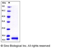 Sino Biological Recombinant Human Cystatin B Protein (His Tag), Quantity: