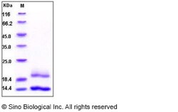 Sino Biological Human Cystatin E / CST6 Protein (His Tag) 20ug, Quantity: