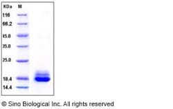 Sino Biological Recombinant Human Nectin-2 Protein (His & AVI Tag), Biotinylated,