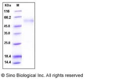 Sino Biological Human CCN4 / WISP1 Protein (His Tag) 100ug, Quantity: Each