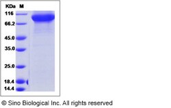 Sino Biological Recombinant Human FLT3 Protein (T227M, ECD, His Tag), HPLC-verified,