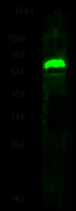 Sino Biological Arylsulfatase A / ARSA Antibody, Rabbit PAb, Antigen Affinity