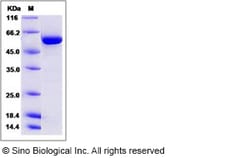 Sino Biological Recombinant Human TGF-beta RI Protein (aa 200-503, His
