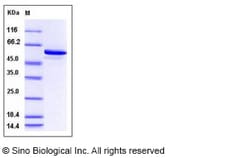 Sino Biological Recombinant Human BMPRIB Protein (aa 149-502, His & GST