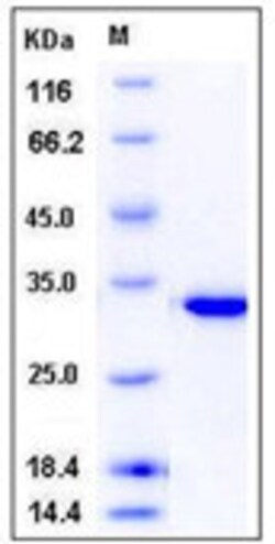 Sino Biological Recombinant Human CA13 Protein (His Tag), HPLC-verified,