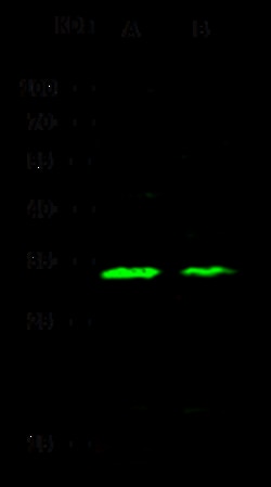 Sino Biological Human CA13 PAb 100ul (Sino Biological), Quantity: Each