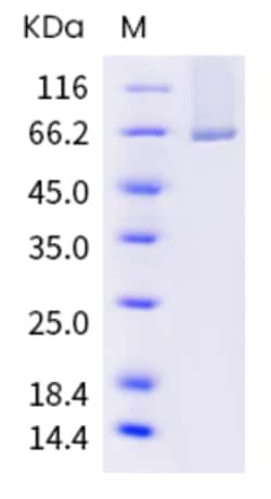 Sino Biological Human FAP Protein 50ug (Sino Biological), Quantity: Each