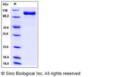 Sino Biological Recombinant Human FAP Protein (ECD, His Tag), HPLC-verified,