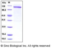 Sino Biological Recombinant Human Nogo Receptor/RTN4R Protein (His & hFc