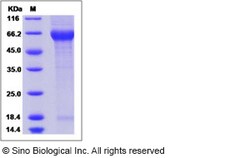 Sino Biological Recombinant Human Nogo Receptor/RTN4R Protein (His Tag),