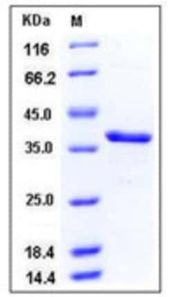 Sino Biological Recombinant Human Carbonic Anhydrase 8/CA8 Protein (His