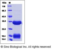 Sino Biological Human Carbonic Anhydrase IV / CA4 Protein (His Tag) 20ug,