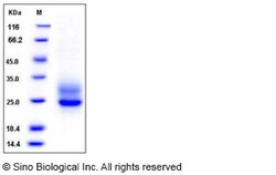 Sino Biological Human Frizzled-5 / FZD5 Protein (His Tag) 1mg, Quantity:
