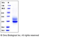 Sino Biological Human Frizzled-5 / FZD5 Protein (His Tag) 100ug, Quantity: