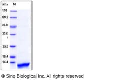 Sino Biological Human CCL14 / HCC-1 / HCC-3 Protein (His Tag) 50ug, Quantity: