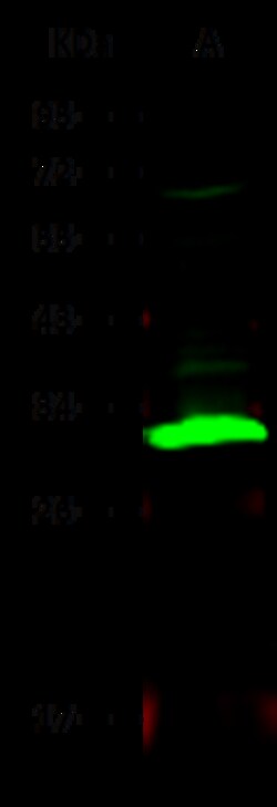 Sino Biological Carbonic Anhydrase II / CA2 Antibody, Rabbit MAb 100µL,