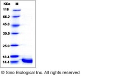 Sino Biological Recombinant Human Cystatin A Protein (His Tag), Quantity:
